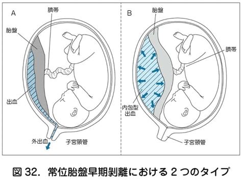 胎盤形成時期|胎盤の基礎｜完成時期や役割・妊娠中の胎盤トラブル 